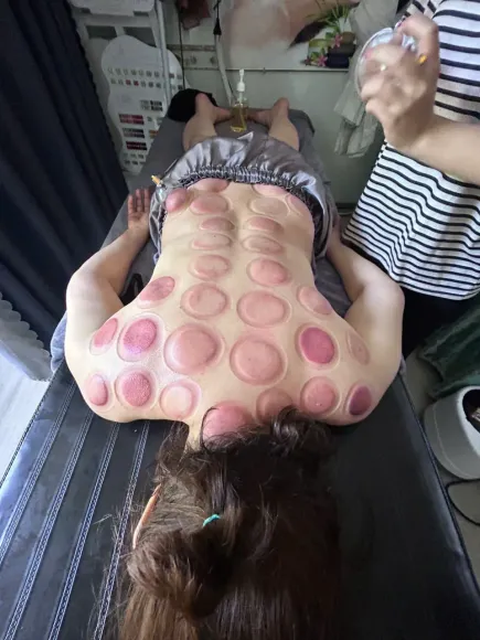 LIÊN KIỀU SPA – DỊCH VỤ GIÁC HƠI THẢI ĐỘC ĐANG ĐƯỢC ƯA CHUỘNG HIỆN NAY